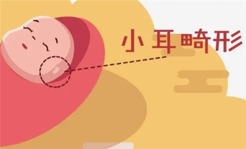【河南中醫(yī)藥大學(xué)一附院】莊洪興教授暑假坐診，耳畸形修復(fù)限時預(yù)約！