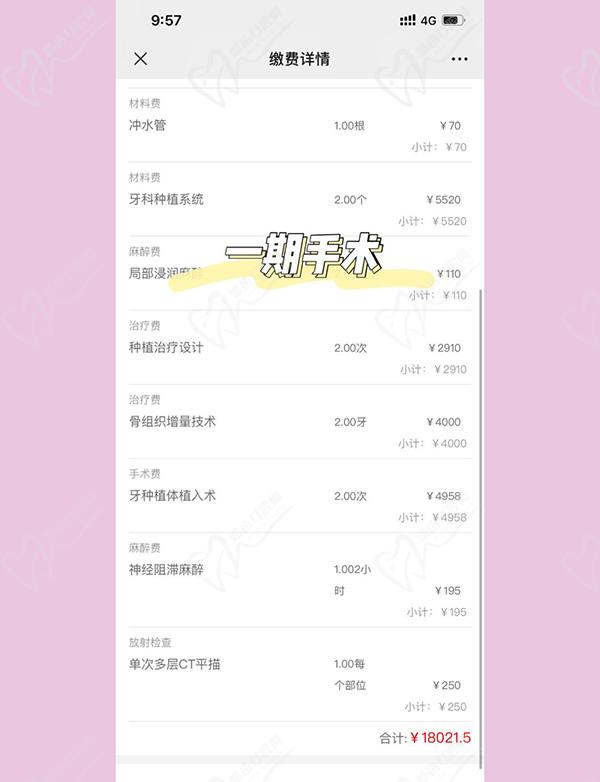 華西口腔醫(yī)院種植牙收費票