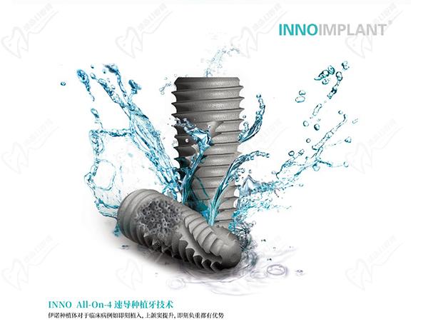 韓國inno伊諾種植牙