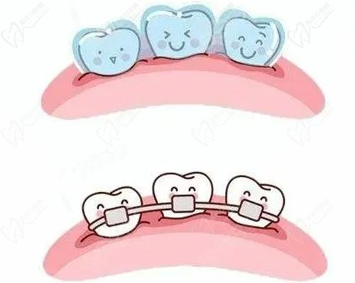 株洲優(yōu)伢仕口腔醫(yī)院牙齒矯正實(shí)力不弱