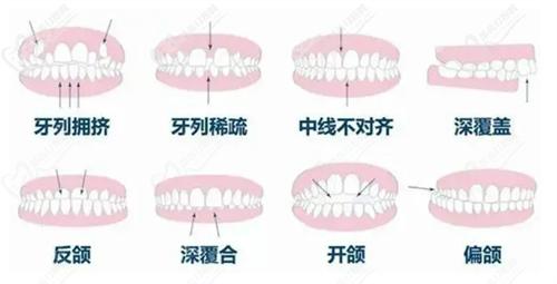 株洲優(yōu)伢仕口腔醫(yī)院牙齒矯正實(shí)力強(qiáng)