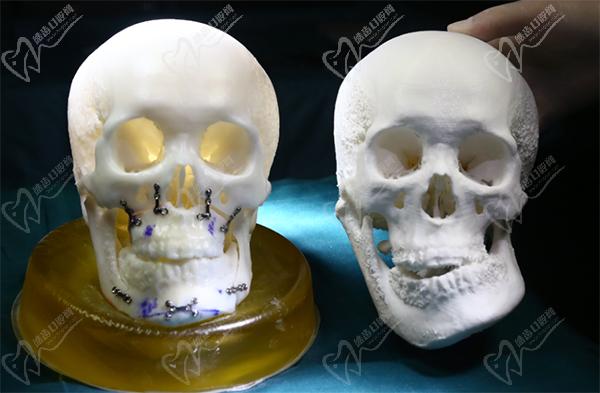 沈陽杏林整形醫(yī)院正頜手術朱石江