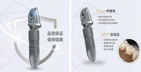 西班牙泰科種植牙怎么樣？
