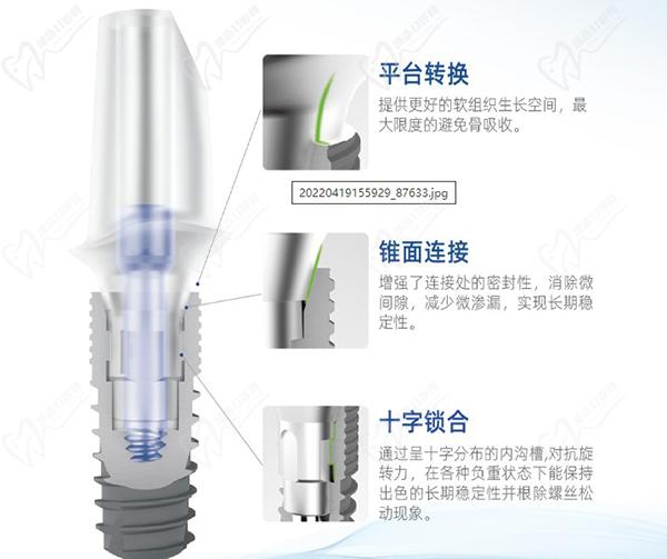 康盛種植牙型號(hào)