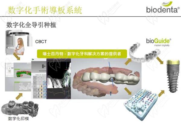 百丹特種植體型號(hào)及產(chǎn)品目錄
