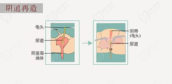 泰國去勢全切的價(jià)格
