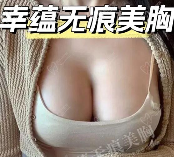 隆胸預(yù)約網(wǎng)上報名