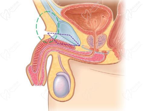 李世榮延長手術(shù)貴在術(shù)后的滿意度，口碑不斷積累