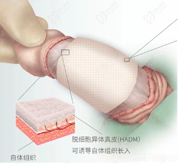 國內(nèi)男科生殖整形醫(yī)院哪家好
