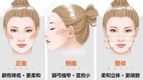 重慶何才偉和安可忍醫(yī)生磨骨技術(shù)特點分析