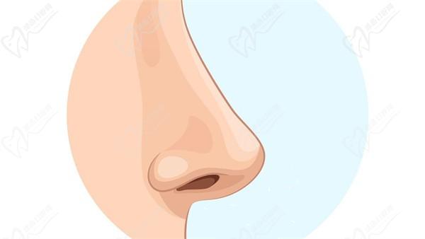 上海葉麗萍醫(yī)生做鼻基底手術(shù)嗎？華美美鼻技術(shù)派親診 自然風(fēng)改善鼻凹有一手